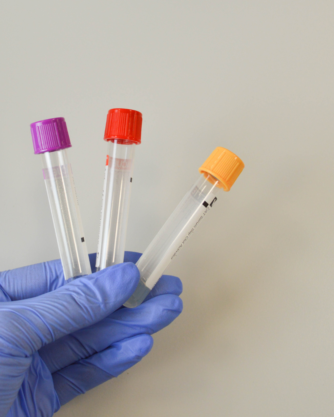 Tres tubos de laboratorio con tapas de colores sostenidos por una mano con guante azul, símbolo de biomarcadores y análisis clínico en SHOMMA.